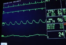 Electro Cardiogram